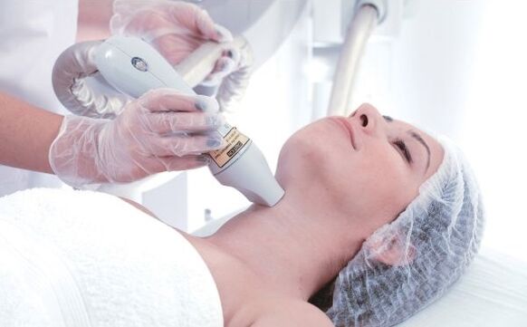 fractional laser kulit resurfacing