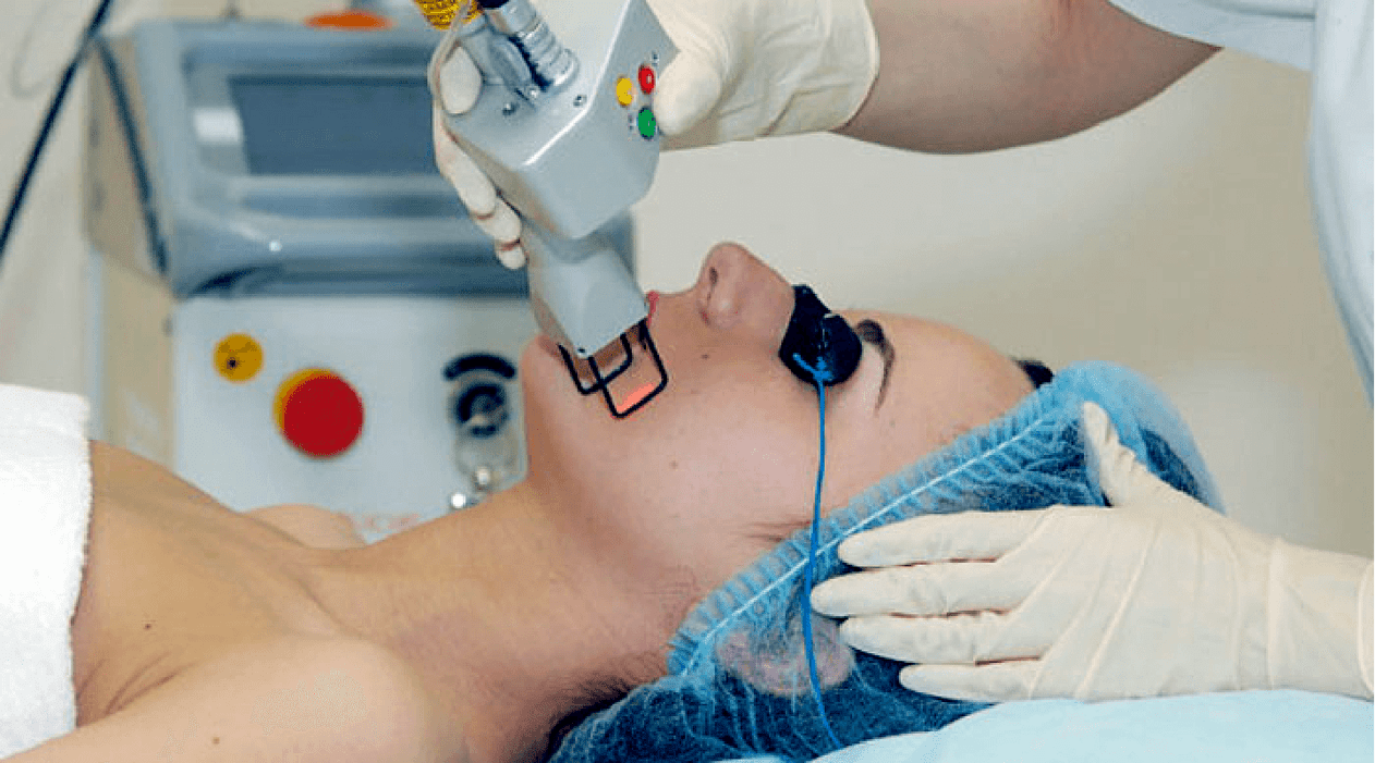 prosedur rejuvenation kulit laser